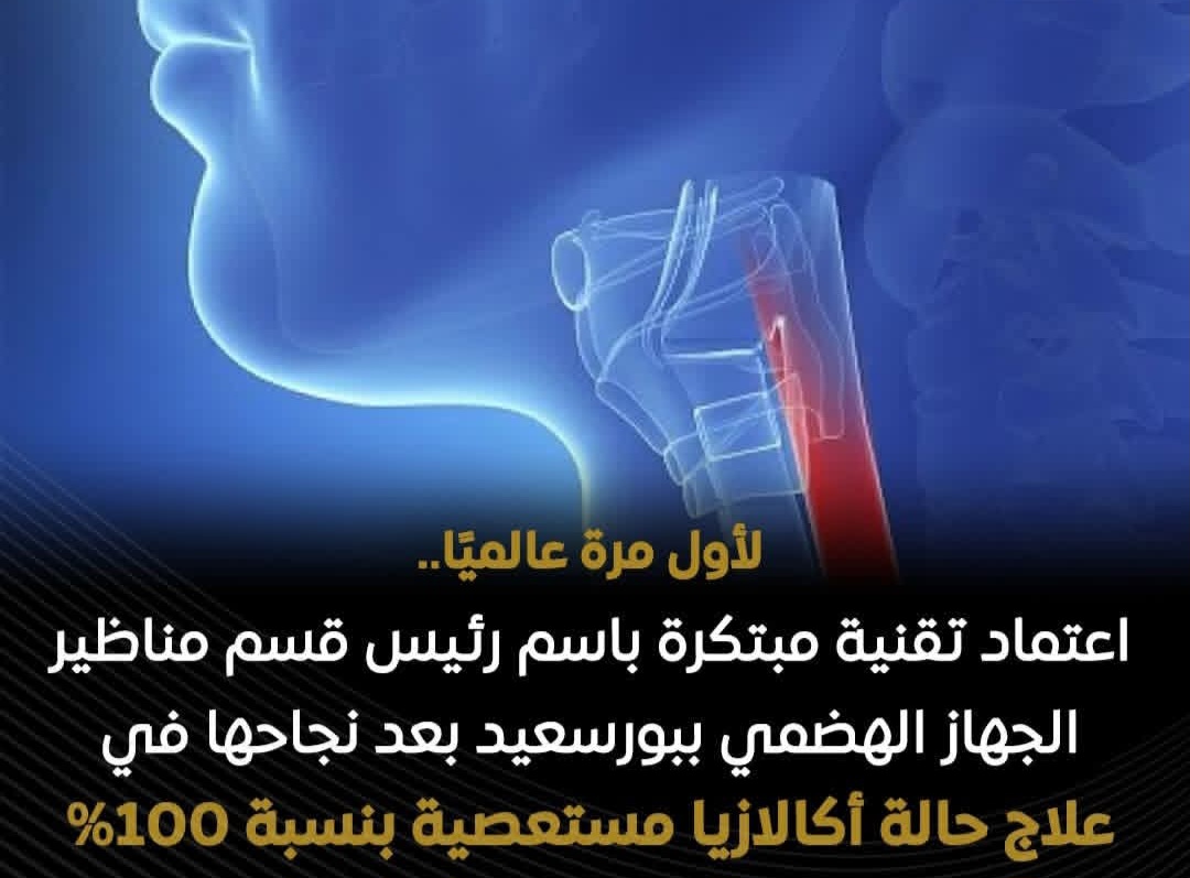 تقنية "مدكور" أول ابتكار مصري يتم اعتماده عالميًا في مناظير الجهاز الهضمي